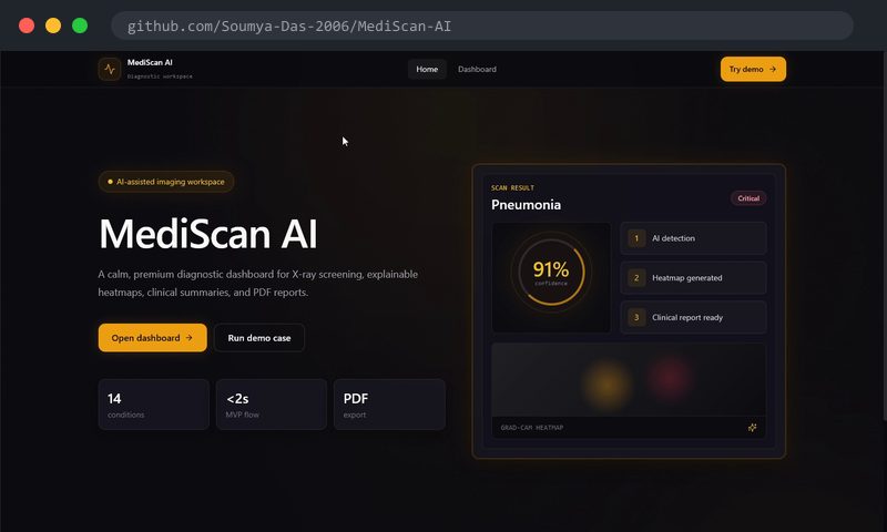 MediScan AI - X-Ray Diagnosis